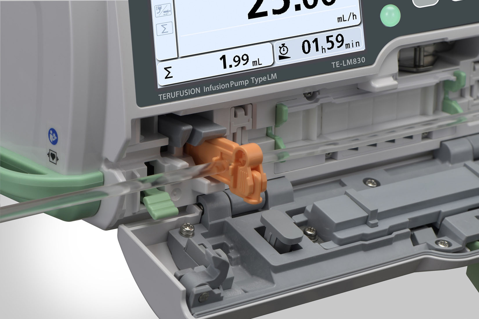 Terumo Smart Midpress Technology Explained