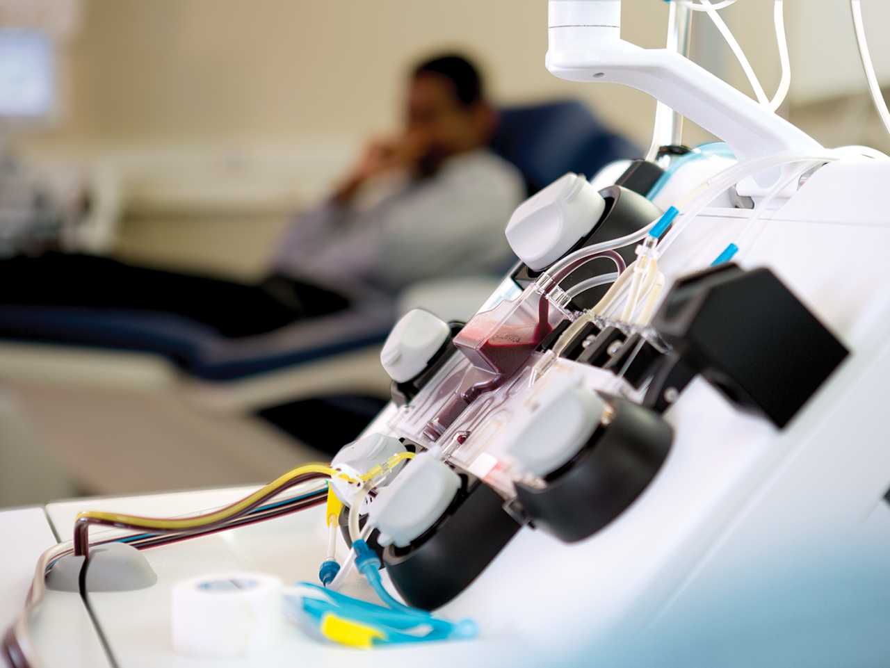 Trima Accel vs Spectra Optia: System Comparison